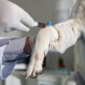 Exame de sangue em cachorro: o que ele pode revelar sobre a saúde do pet? - Aumivet Centro Veterinário